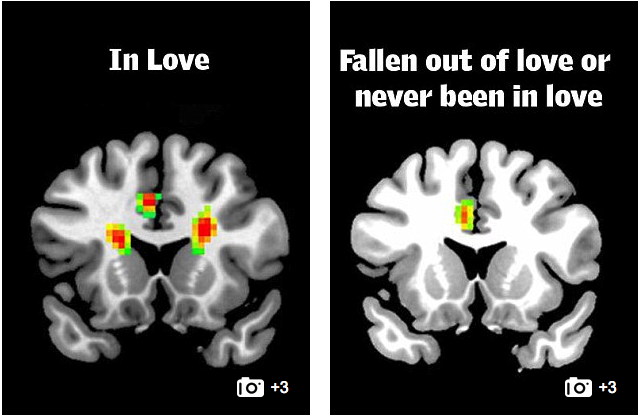 brain in love 1.png